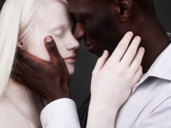 زواج مختلط ( أعراق مختلفة)