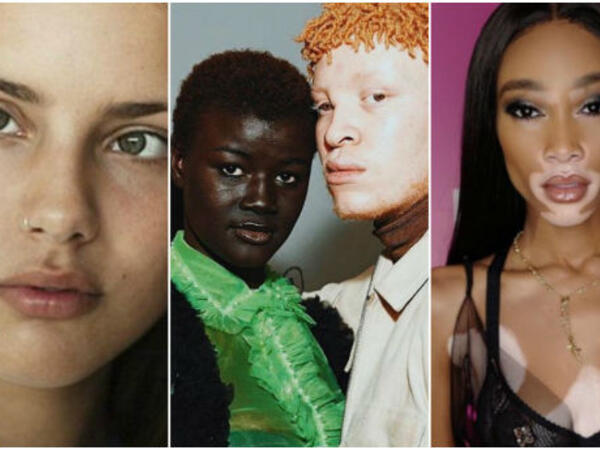 عارضي أزياء بطفرات جينية