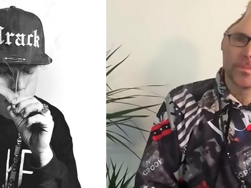 Niko Brennan, whose rapper name is Dr Knarf, is pictured here after surgery to remove a portion of his skull. (Daily Mail)