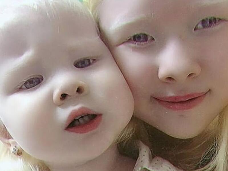 'The doctors were shocked, and thought that she was Russian,' recalls Aiman Sarkitova, their mother (dailymail)
