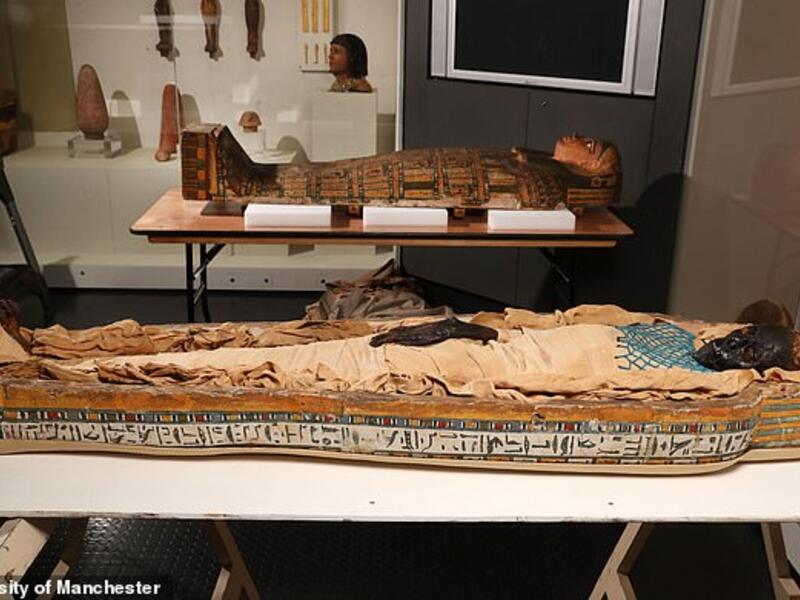 Takabuti was also found to have two bizarre traits seen only in a minority of the population. She had an extra tooth - 33 instead of the normal 32. (University of Manchester)