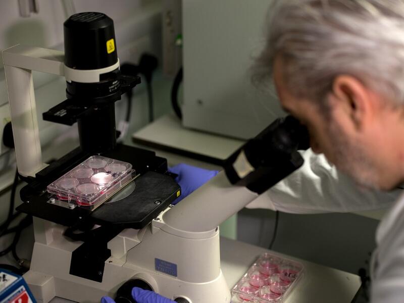 Doctor Paul McKay, who is working on an vaccine for the 2019-nCoV strain of the novel coronavirus, Covid-19,, poses for a photograph using a microscope to look at bacteria containing coronavirus, Covid-19, DNA fragments, in a research lab at Imperial College School of Medicine (ICSM) in London on February 10, 2020. A team of UK scientists believe they are one of the first to start animal testing of a vaccine for the new coronavirus that has killed more than 1,000 people and spread around the world. Tolga AK