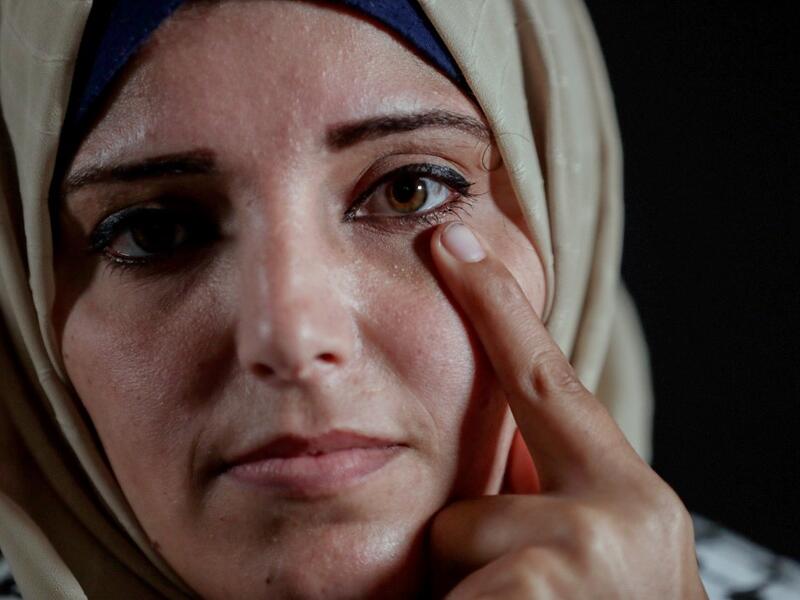 Jacqueline Shahada, who lost her left eye in the ongoing conflict with Israel, poses during a photo session in Bureij refugee camp in central Gaza on February 4, 2020. Along the border of the Gaza Strip, the Israeli army uses snipers who, according to instructions, open fire only when the soldiers are at risk from intensifying violence from Palestinian rioters. Some were taking part in clashes, others simply in the wrong place at the wrong time. All were left scarred and their lives wrecked, even though in 