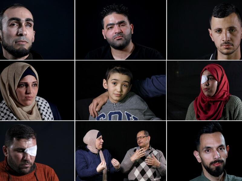 This combination of pictures created on June 8, 2020, shows (top L to R) Ahmed al-Louth, who lost his left eye, posing during a photo session in Bureij refugee camp in central Gaza; Muath Amarneh, who lost his left eye, posing during a photo session in Ramallah; Mohammed Burqan, who lost his right eye, posing during a photo session in Jerusalem; (middle L to R) Jacqueline Shahada, who lost her left eye, posing during a photo session in Bureij refugee camp in central Gaza; Malek Issa, 9, lost his left eye