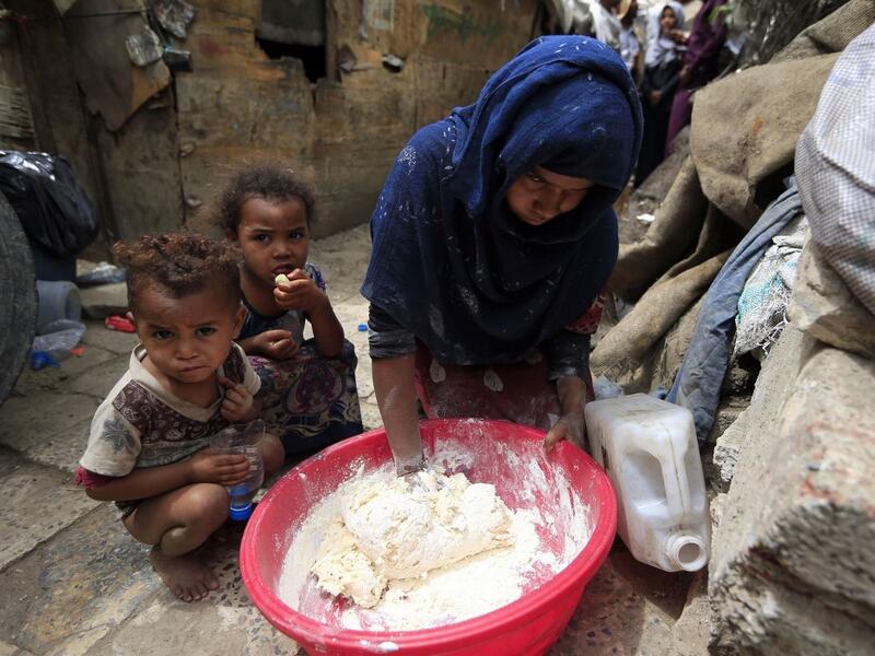 Members of Yemen's minority group known as "Muhamasheen" -- literally the "Marginalised" are pictured at a slum in the capital Sanaa on July 4, 2020. At a time when the Black Lives Matter movement is reshaping societies, black Yemenis have scant hope for an end to centuries of discrimination that has only worsened during the civil war. In Sanaa, members of the minority group known as "Muhamasheen" live in dismal conditions in densely populated slums. They count among the poorest of the poor in the Arab worl