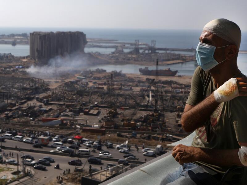 Lebanese TV producer Tony Ahwaji sits injured on the balcony of his damaged apartment in the damaged neighbourhood of Mar Mikhael in the Lebanese capital Beirut on August 6, 2020, two days after a massive explosion shook the Lebanese capital. The blast, which appeared to have been caused by a fire igniting 2,750 tonnes of ammonium nitrate left unsecured in a warehouse, was felt as far away as Cyprus, some 150 miles (240 kilometres) to the northwest. The scale of the destruction was such that the Lebanese ca