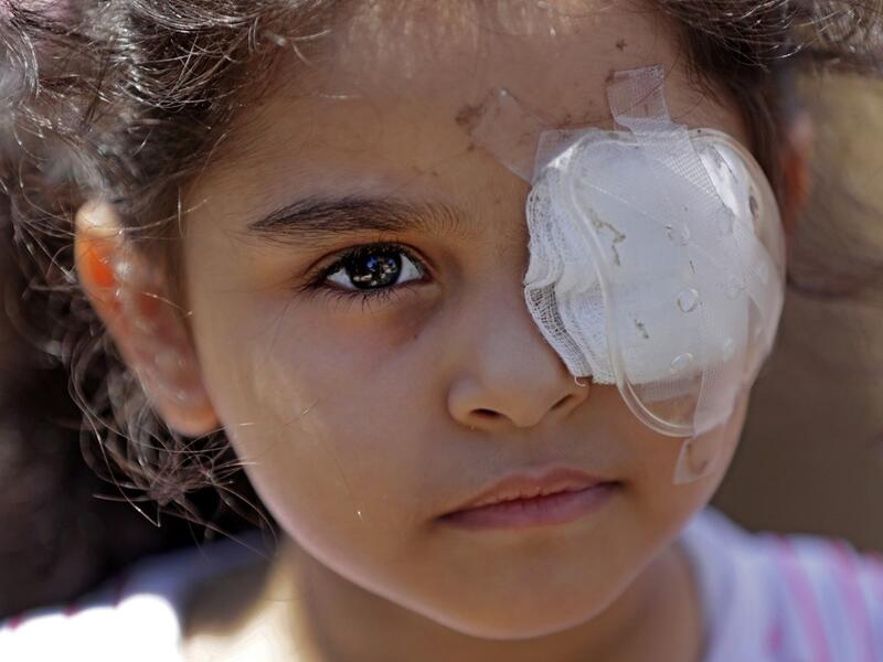 Sama al-Hamad, 6-year-old Syrian girl who lost her left eye in the August 4 cataclysmic explosion, poses for a picture on the roof of her damaged house in Beirut's Mar Mikhael district overlooking the blast site on August 16, 2020. ANWAR AMRO / AFP