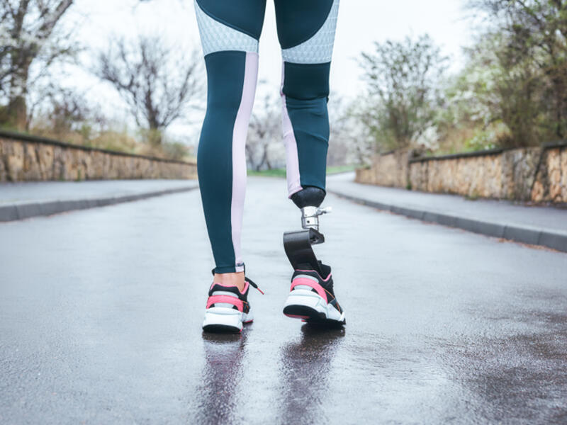 prosthetic limbs