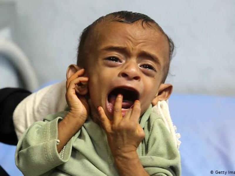 Spare a thought for the Yemeni kids 