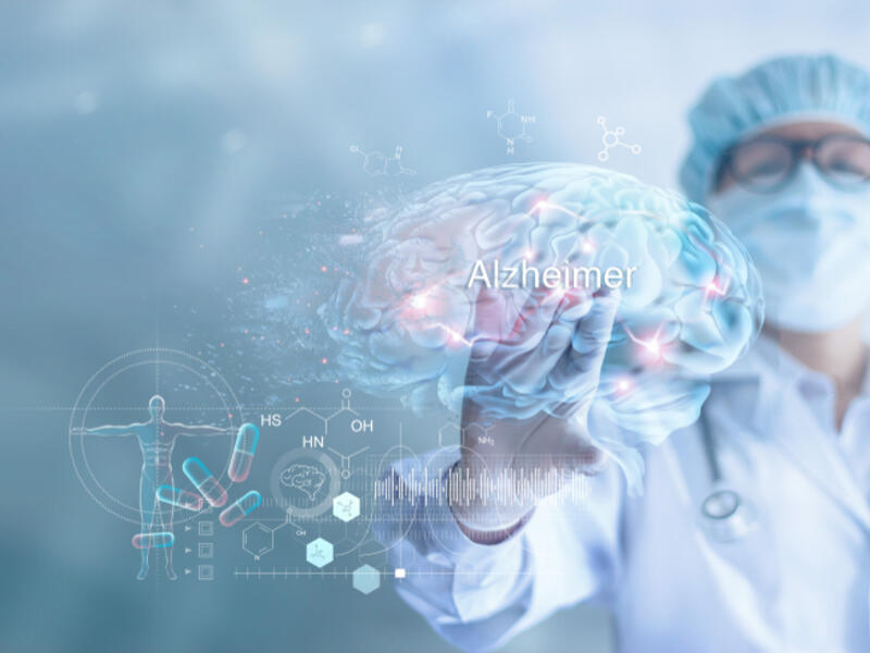 Doctor checking and analysis alzheimer's disease