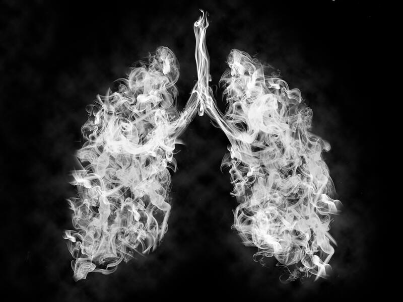 Please quit smoking
