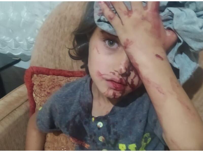 أتراك يعتدون على لاجئين سوريين في أنقرة