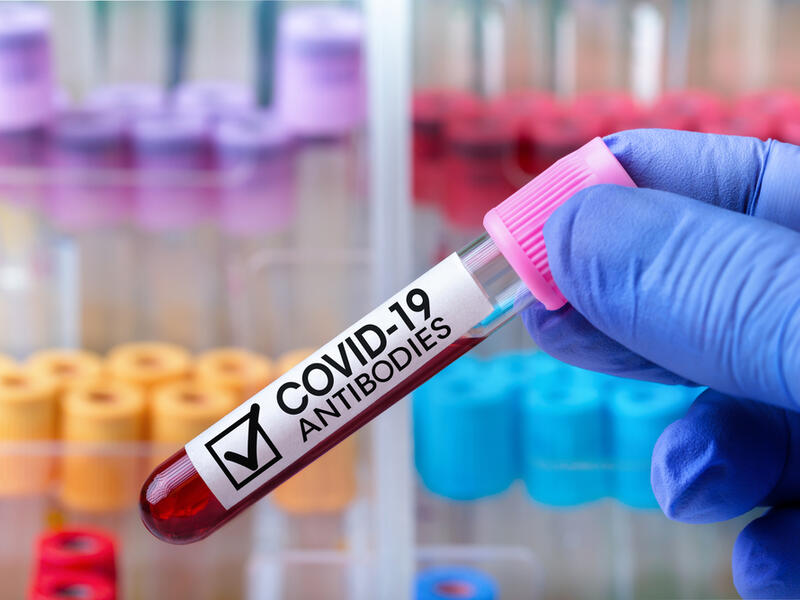 Antibodies from COVID-19 infection may last up to 20 months