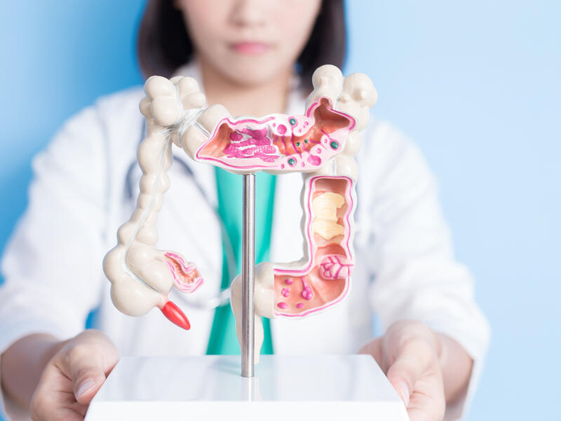 Colorectal Cancer