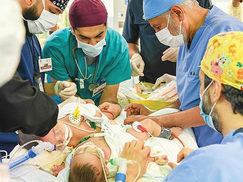 فصل التوأم اليمني مودة ورحمة 