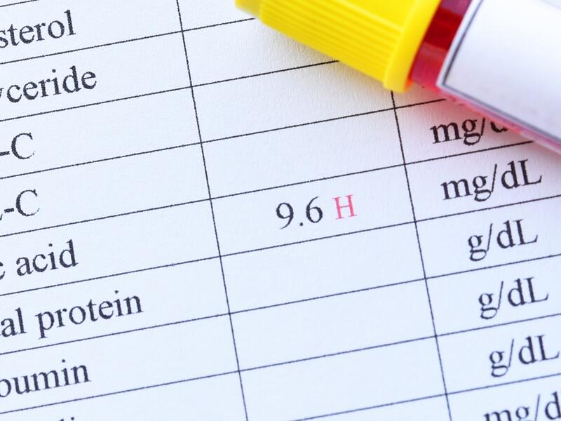 طبيب البوابة: لماذا يجب ألا تتجاهل التورم المؤلم في مفاصلك
