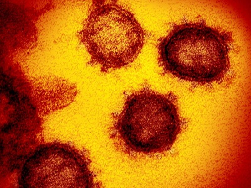The electron virus 