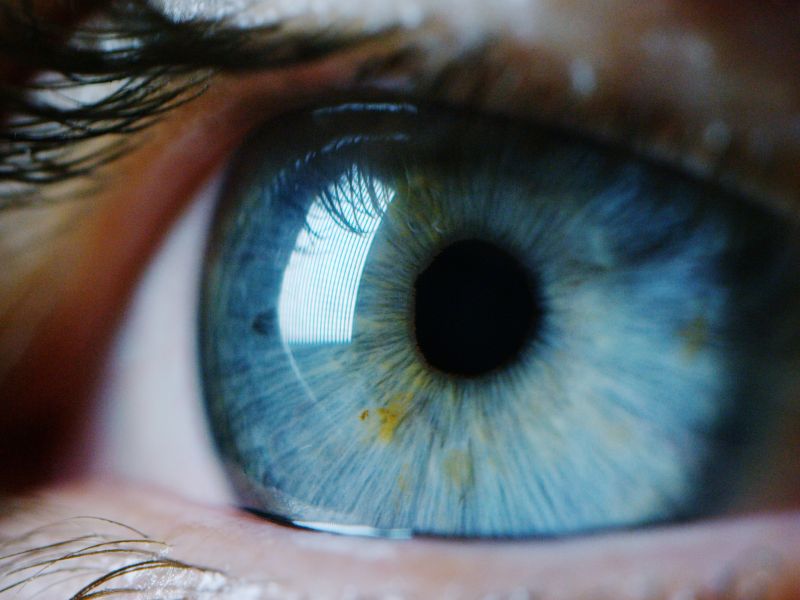 blue eyes