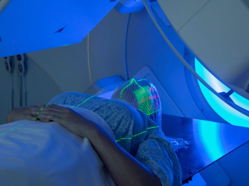 radiation therapy