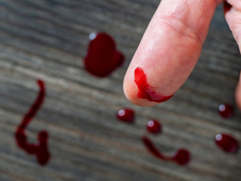 اكتشف المعنى الروحي لرؤية الدم في الحلم