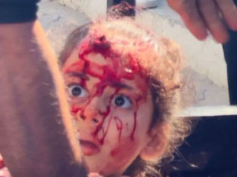 UN urges immediate action to stop Israeli genocide in Gaza 