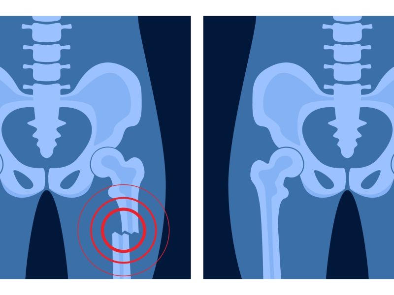 bone glue