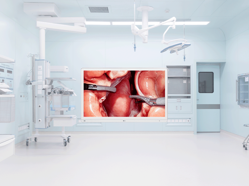 LG Launches 4k Surgical Monitor With Intelligent Features to Optimize Surgical Workflow