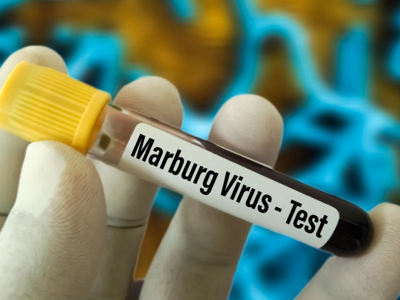 فيروس ماربورغ