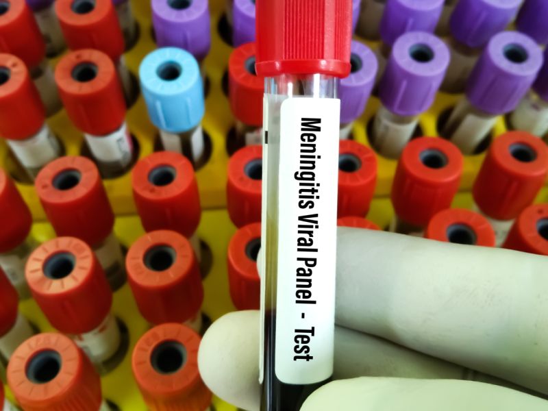 التهاب السحايا: الأعراض، المضاعفات، طرق الوقاية