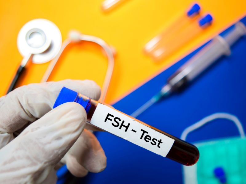طرق طبيعية لعلاج ارتفاع هرمون FSH بالأعشاب