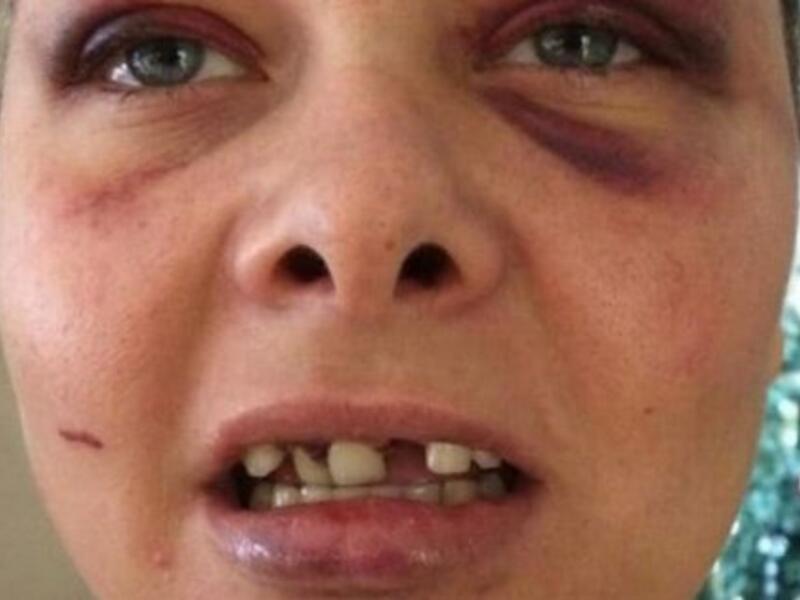 Lois Ashton (Twitter)