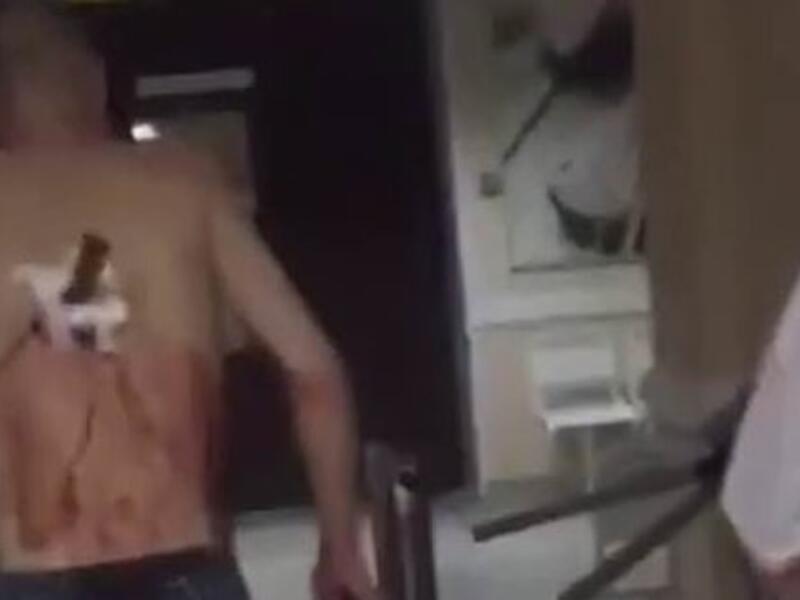 Man with Knife in His Back (Twitter)