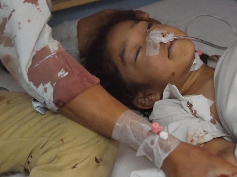 An 8-year-old Afghan treated in hospital after the suicide bombing. (AFP)