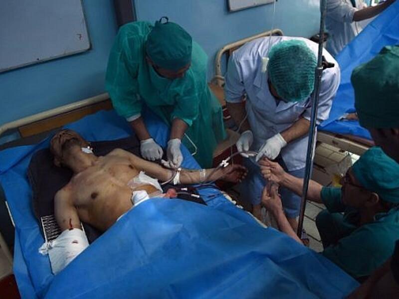 A wounded Afghan resident is treated following a suicide bombing attack at the Istiqlal Hospital in Kabul on April 22, 2018. (AFP Photo/ Wakil Koshor)