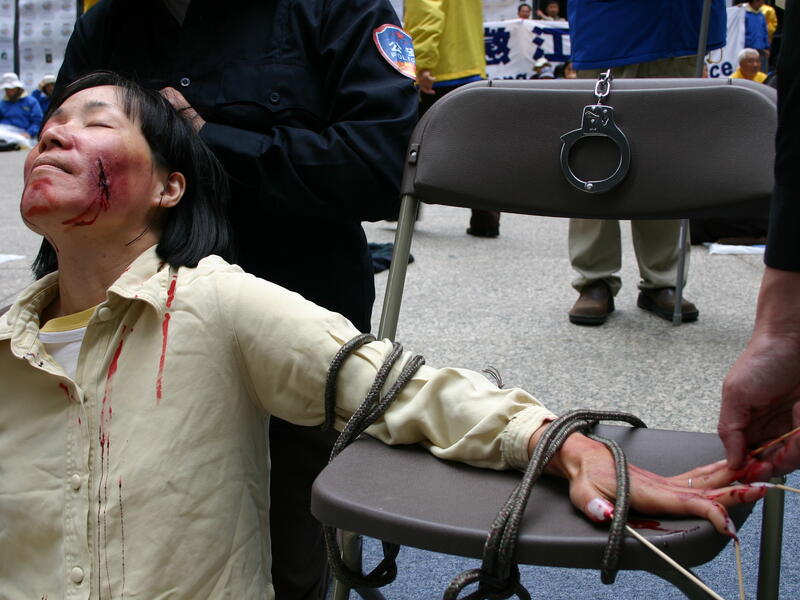 Fingernail Pulling, As benign as this sounds, having your fingernails ripped off is excruciatingly painful. This technique has been used since the beginning of recorded history by both state and non-state actors (gangs, mafia, etc). It has also been called “denailing.” (Minghui.org)
