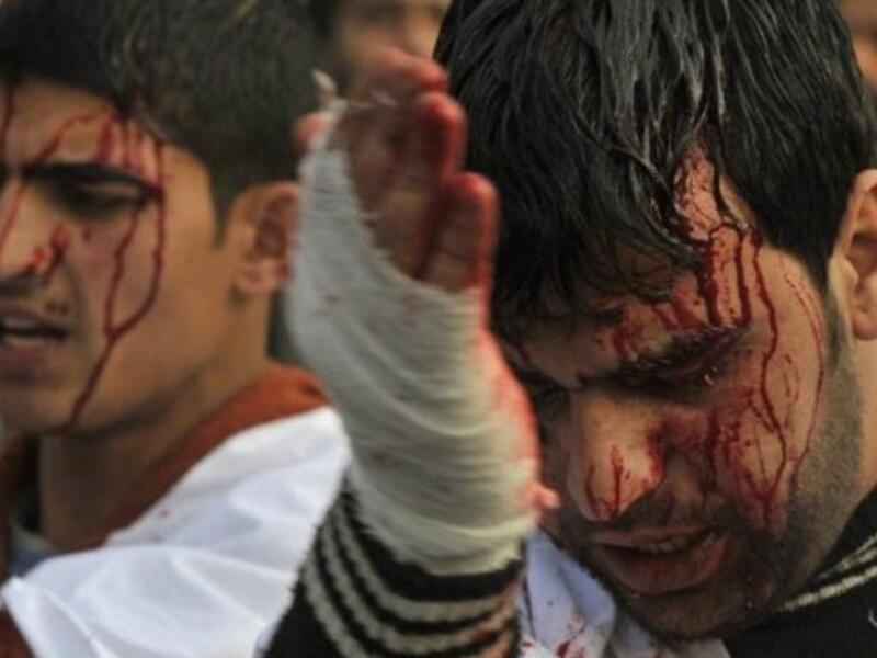 Ashura's rituals: Shia men & women dressed in black parade the streets slapping their chests & 
chanting. Things can get ugly, even violent, with all the raised testosterone around (even if mostly directed at oneself).
Still, today, blood-spilling or self-injury is frowned upon and has been toned down, or kept to the minimum symbolic gestures.

