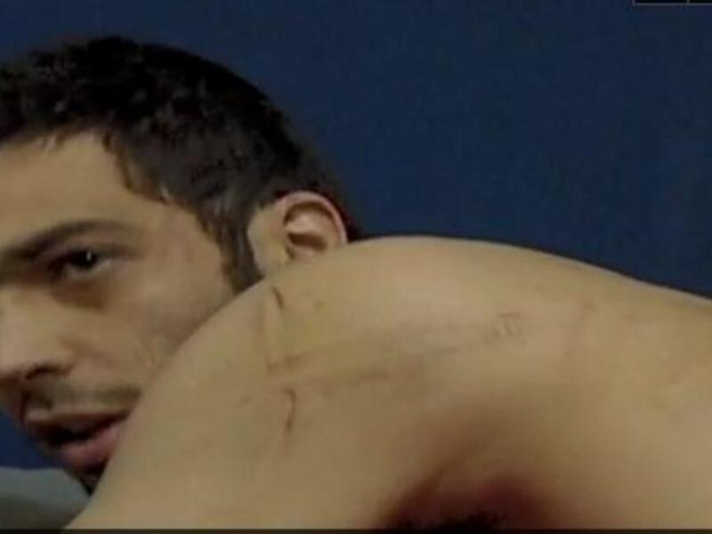Reports of that same 'hand' of the trusted military raining down blows on its people with iron rods, electrical devices, and the stamping of its army boots on the  face of victim, singer and protester, (Rami Issam ,below), one of many tortured during crackdown in March.