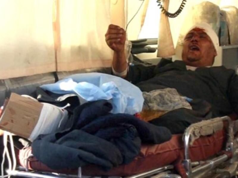 An injured Iraqi waits in the back of an ambulance in Karbala.