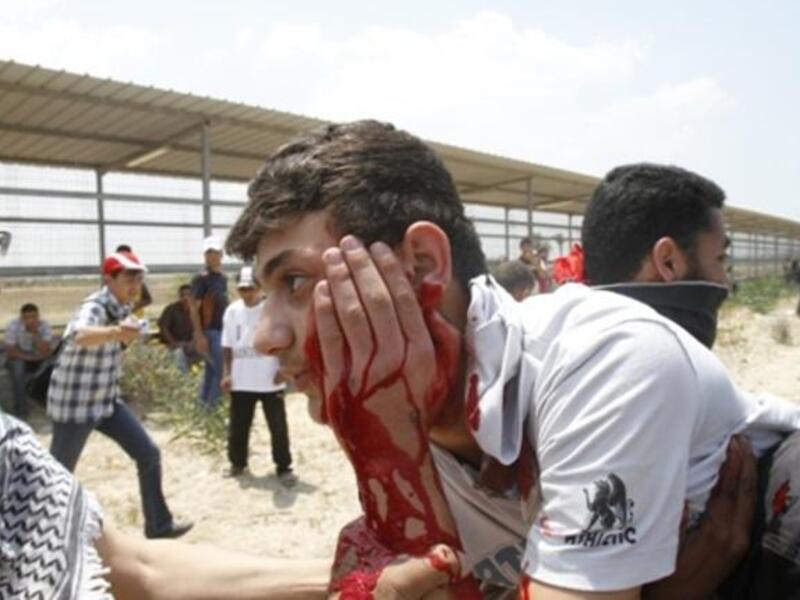 Gaza Guard: Palestinians carry away a wounded man as Israeli troops opened fire during on a massive march heading towards the Erez border crossing in the northern Gaza Strip. 45 injuries counted. 