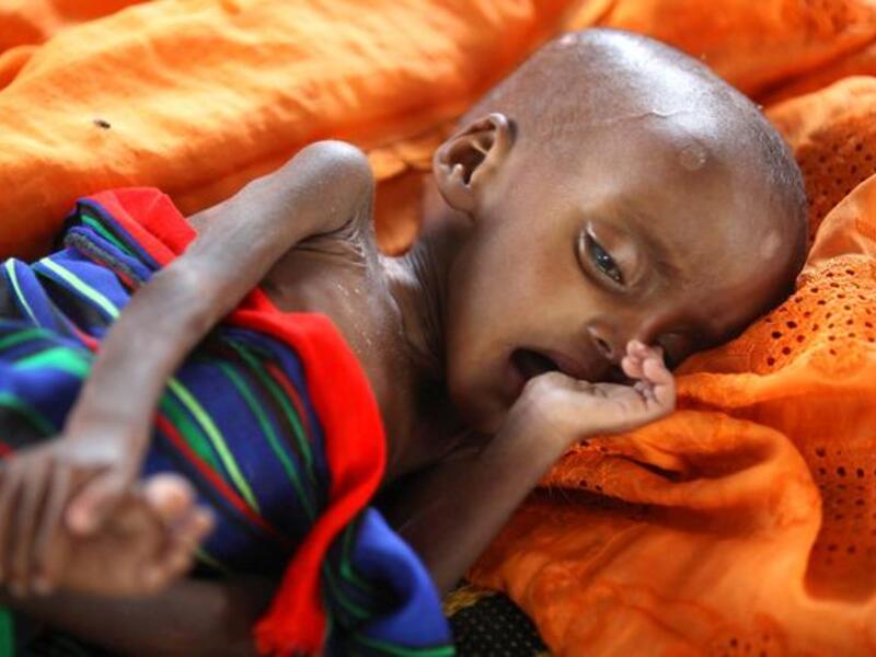 25,000 people die each day of hunger or related diseases. More than $123 million worth
of food is bought and dumped in the US alone, and in the Middle East too we throw perfectly edible leftovers. Often not even 
feeding them to animals. Wasted food goes straight into landfills, not extra mouths.
