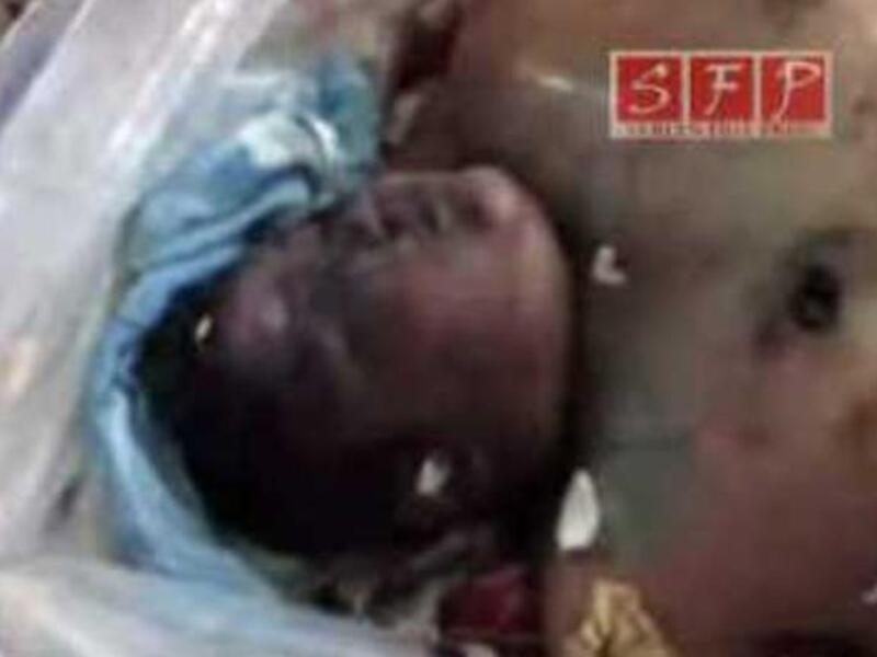 Syrian victim
