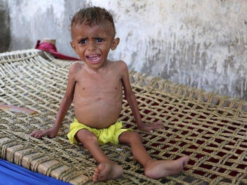 A malnourished Yemeni boy sits on a wooden bench on 26 September 2016. (AFP)