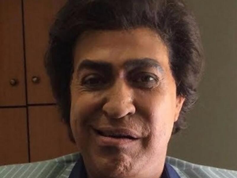 أعلن الفنان حكيم تضامنه مع الفنان الكبير أحمد عدوية وذلك بعد مطالبة الموسيقار حلمي بكر له باعتزال الفن بالتوقف على الغناء حكيم عبر عن تضامنه بطريقة مبتكرة حيث تقمص شخصية عدوية وخضع لماكياج جعله شبه ملامح عدوية لحد كبير وحرص على ارتداء ملابس تشبه ملابس عدوية.
