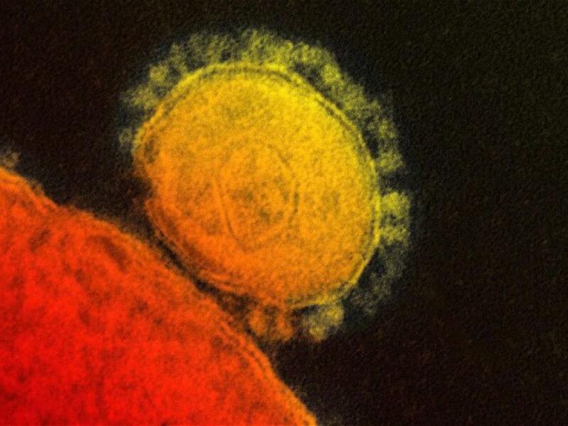 The MERS virus has now reached Iran (File Archive/ AFP).