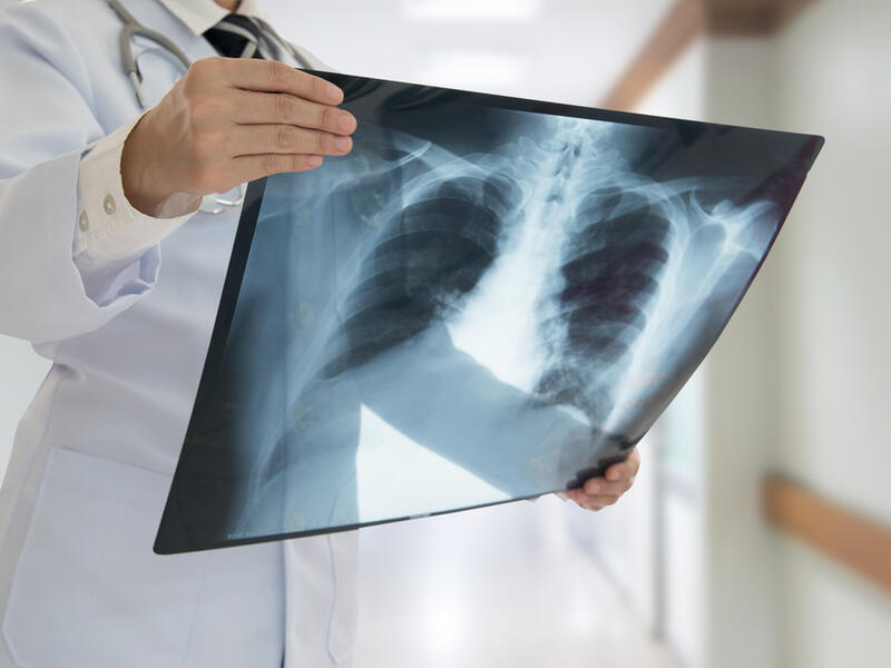 It was during a chest CT scan that the cause of her symptoms came to light (Shutterstock/File)