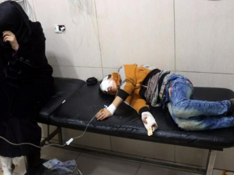 Wounded Syrians are seen on a table in a crowded makeshift hospital in eastern Aleppo. (AFP/File)