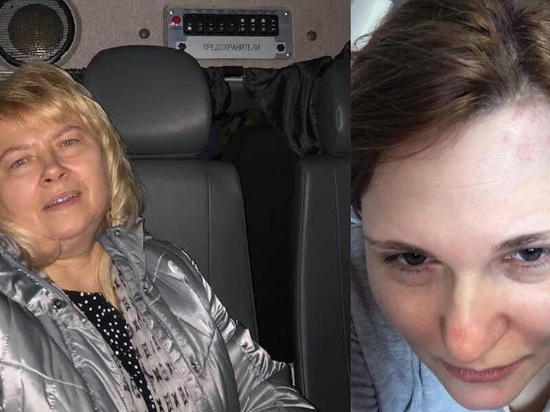 Human rights lawyer Marina Dubrovina in a police vehicle, and journalist Elena Milashina following separate attacks in Chechnya. Elena Milashina/Facebook
