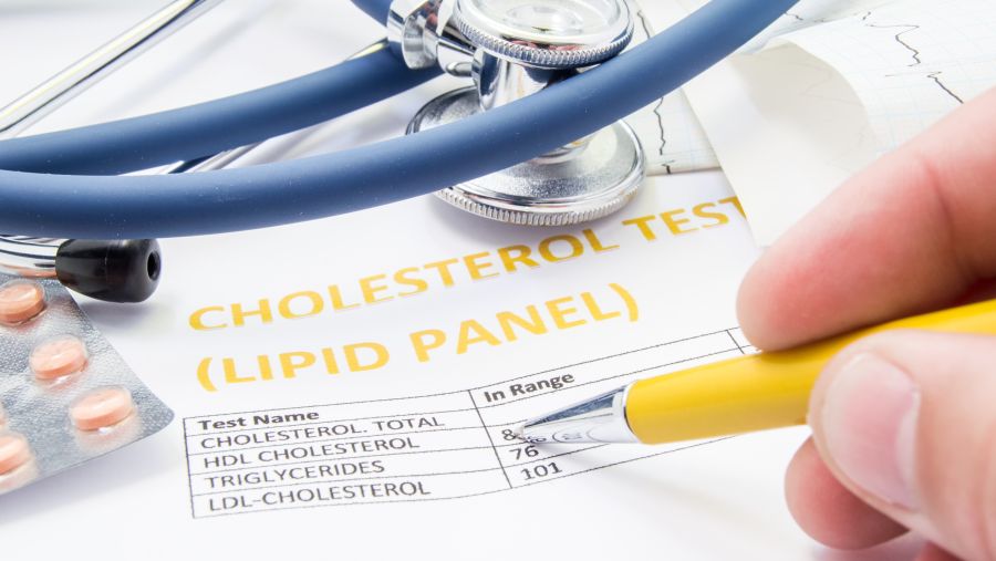 WCM-Q experts call for a global rethink on statin guidelines for older adults