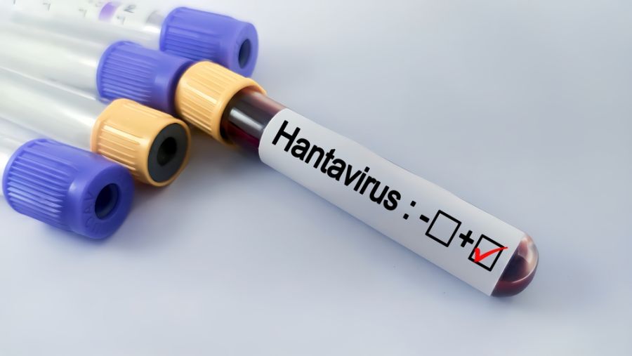 Hantavirus 