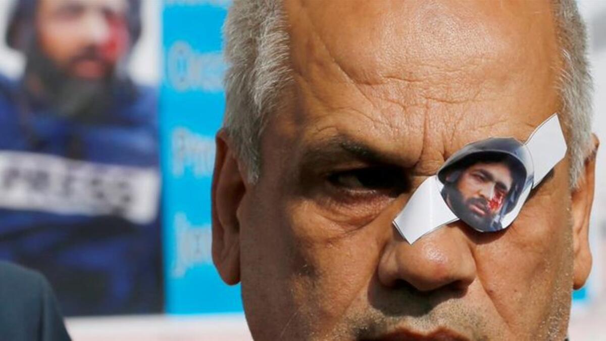 Palestinians are showing solidarity with him by sharing photos of themselves with one closed eye (Twitter)